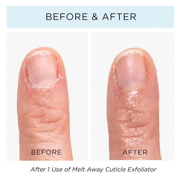 before and after cuticle image