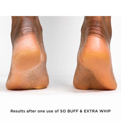 Before & After Extra Whip Shea and Cocoa Seed Butter 